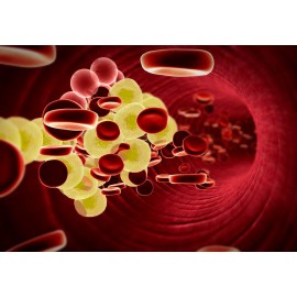 Как снизить уровень холестерина?